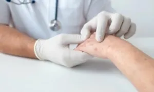 Nhận biết mụn cóc do HPV gây ra